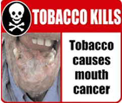 India 2006 Health Effects Mouth - mouth cancer, gross, skull symbol
